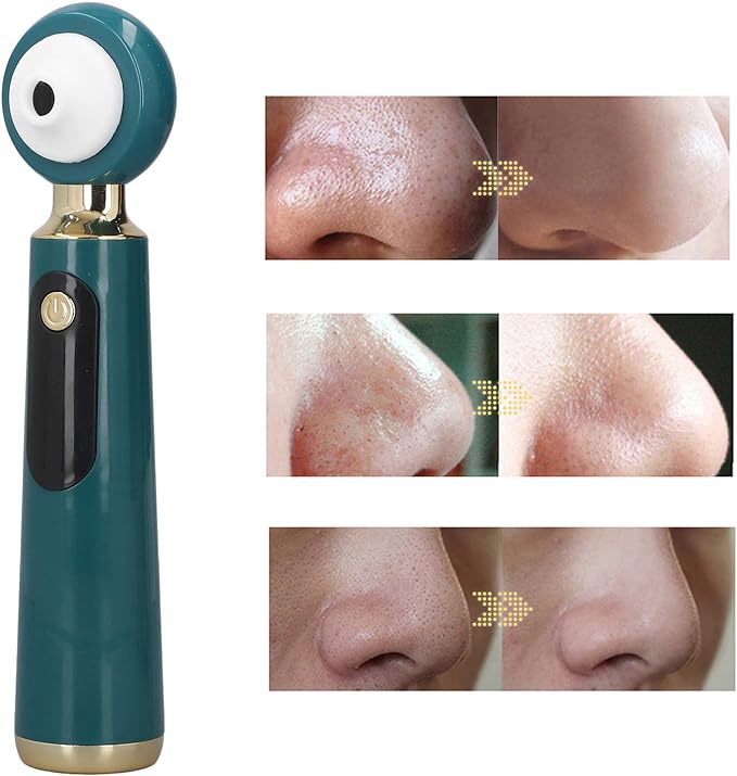 Extractor de Puntos Negros