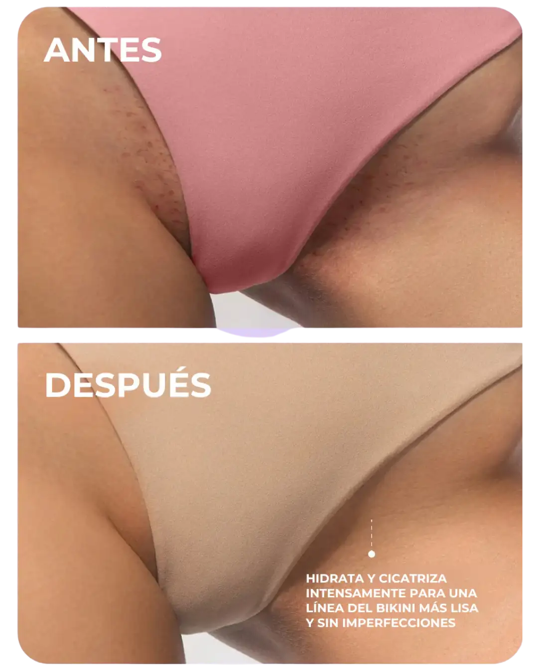 TRULY | Aceite íntimo después del afeitado - 50% De Descuento + Envío Gratis