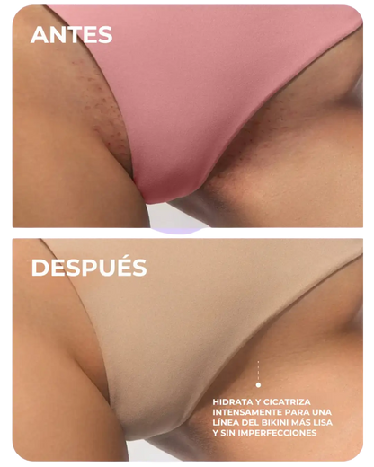TRULY | Aceite íntimo después del afeitado - 50% De Descuento + Envío Gratis